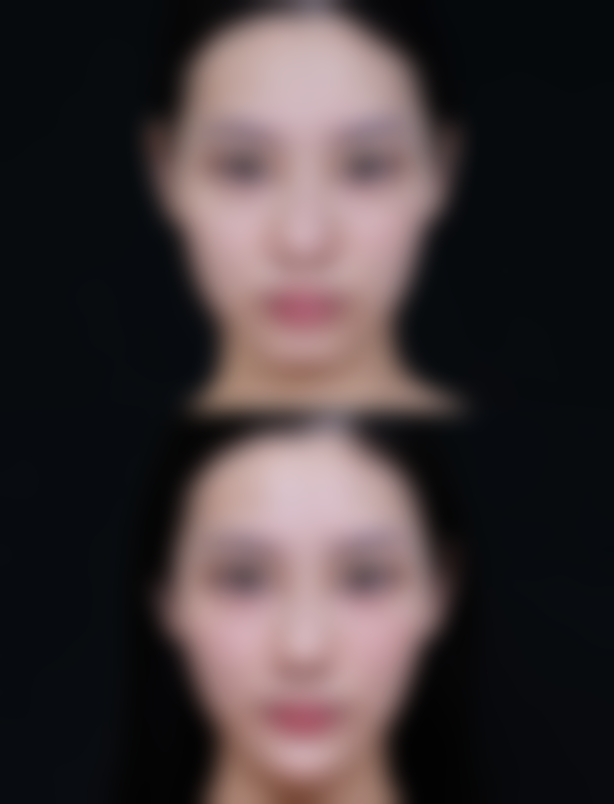 韩昇烈怎么预约？