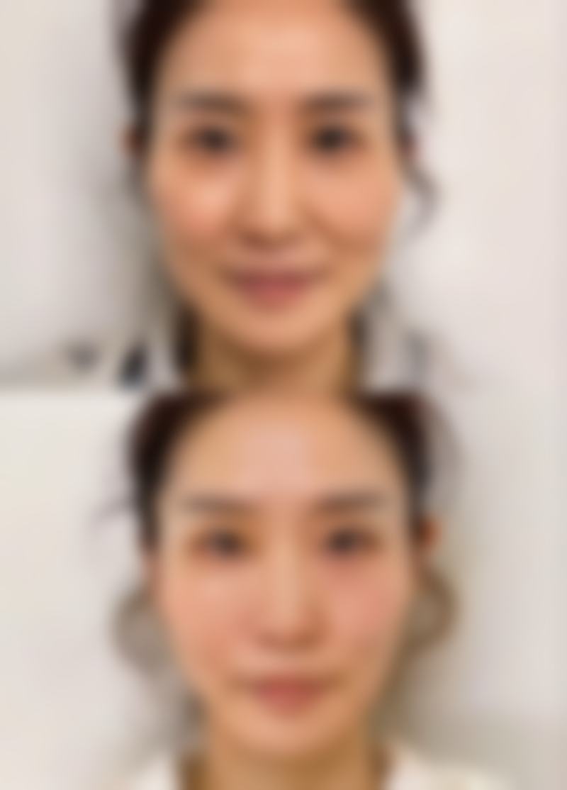 四、广州愈生中医院整形美容科实例