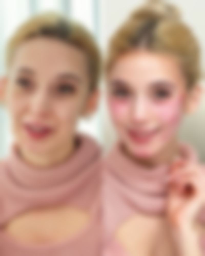 术后稳定期（7天以上）：可以正常使用身体乳