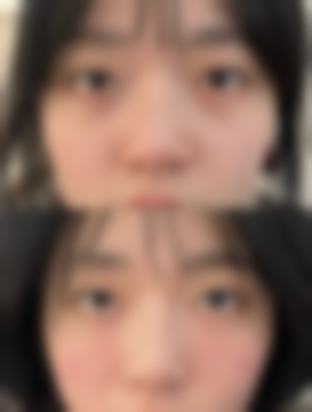 四、涟水县云祥整形医院实例