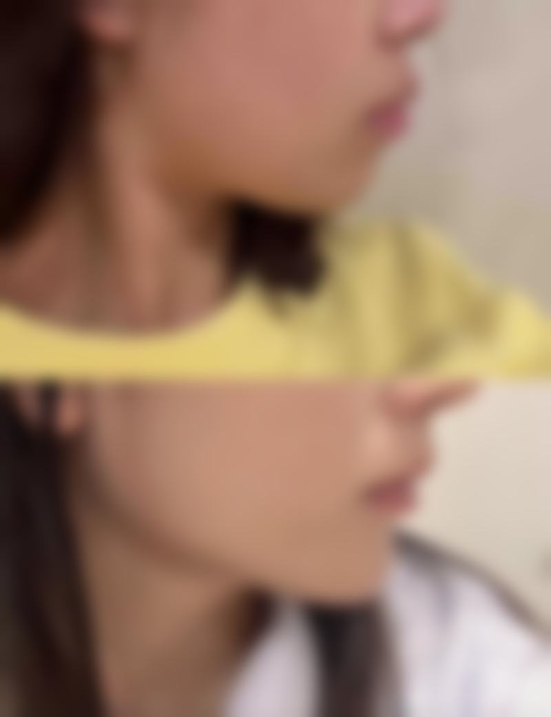 五、宁乡优依美医疗美容诊所怎么预约: