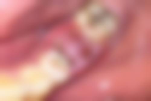 术后疤痕修复选啥好?祛疤贴实测有惊喜