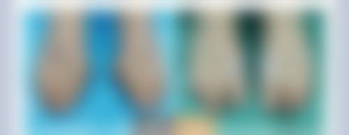 六、东莞塘厦贝芙丽整形医院价格表：（仅供参考）