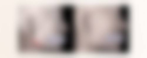 揭秘！桃花眼综合手术，打造专属魅力眼型