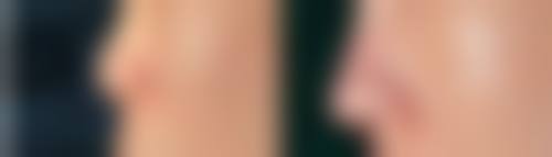 五、深圳悦心悦时医疗美容诊所实例