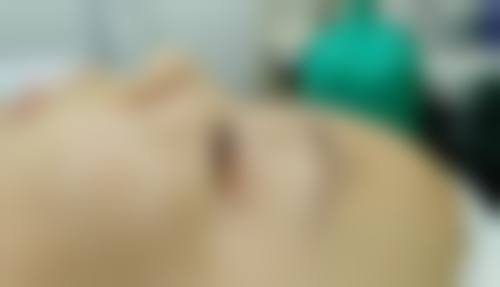 做了阴道紧缩术多久能同床?修复期身体信号要留意