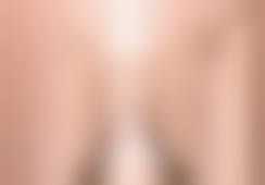 五、新疆乌鲁木齐黎美医疗美容整形怎么预约：