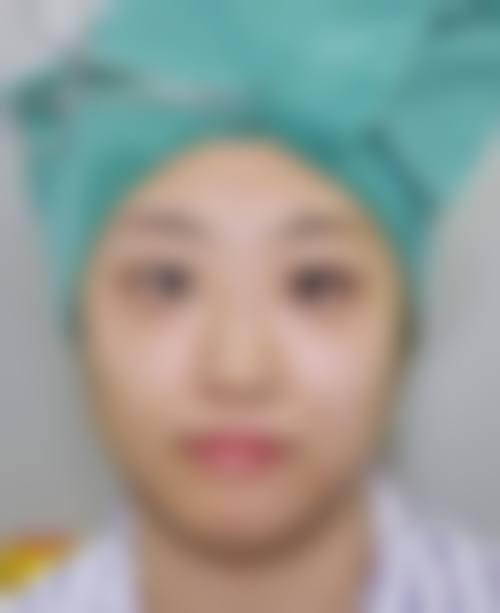 李惠圆在哪家医院