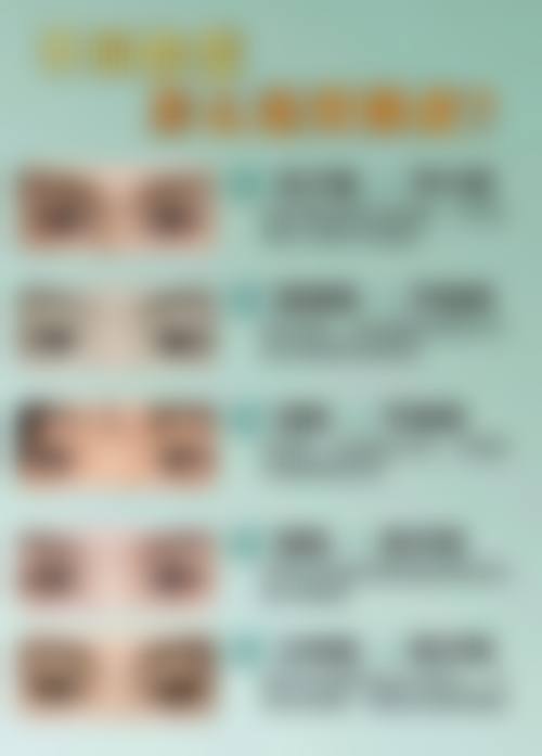 沈珍熙怎么预约？