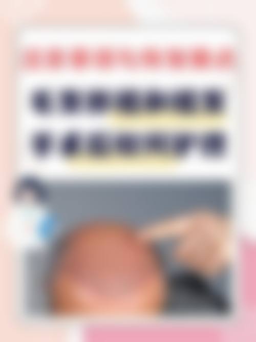 陈天玉植发养发实例