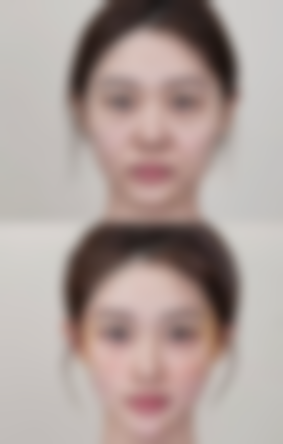 五、海口焦仕程整形医院怎么预约：