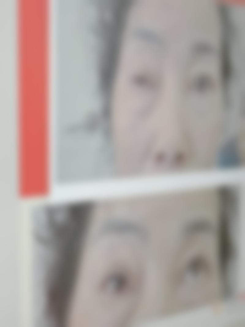 哪种膨体材料隆鼻成效佳？从医院选择看膨体隆鼻保护