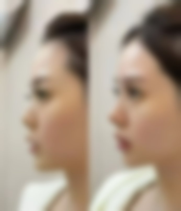 五、韩国S - ONE整形外科医院怎么预约: