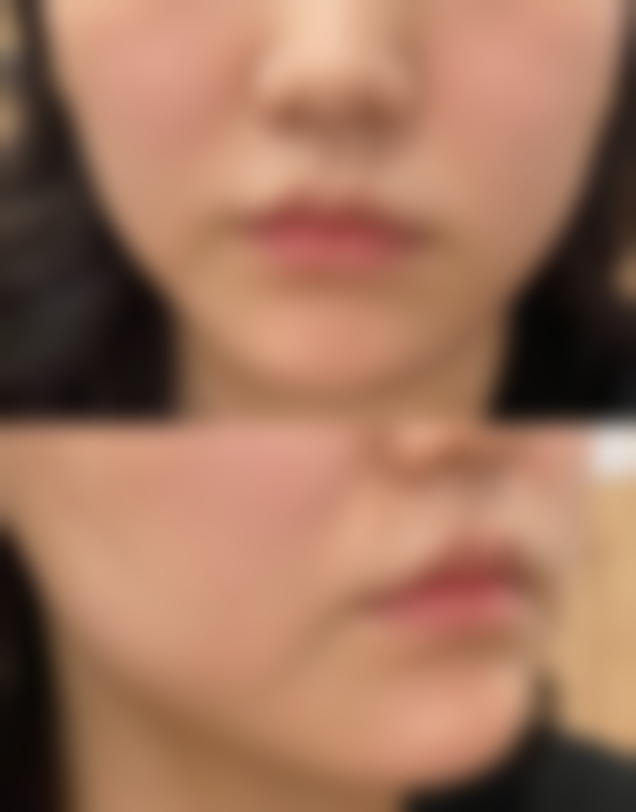 六、新疆乌鲁木齐黎美医疗美容整形价格表：（仅供参考）