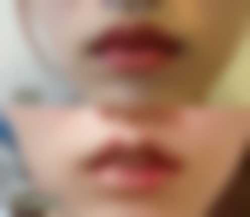 四、武汉李莲珍医疗美容诊所实例