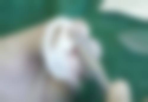 增生疤痕做光子嫩肤后，注意这些修复更快