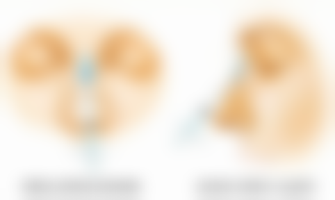 疤痕皮肤究竟选哪家医院?靠谱医院推荐