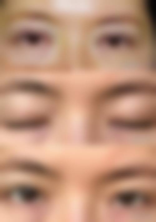 郑甫滥在哪家医院