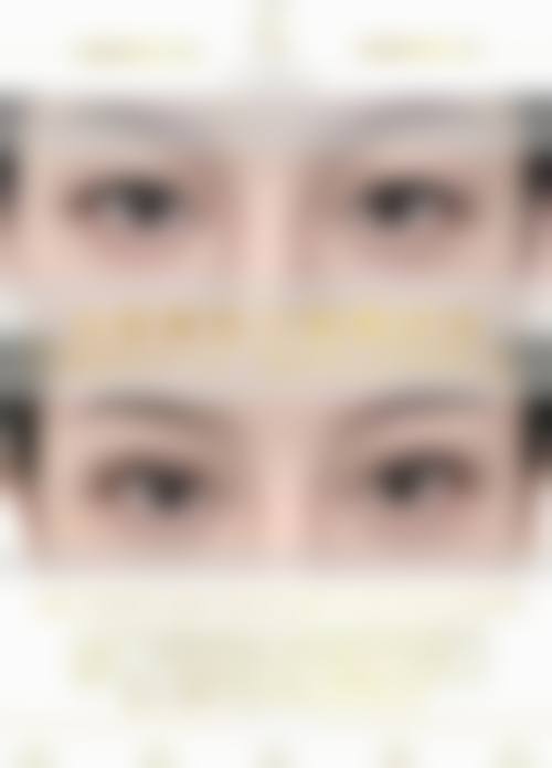 李惠圆眼部整形水平怎么样可靠吗？