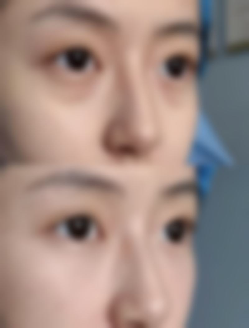 李惠圆在哪家医院