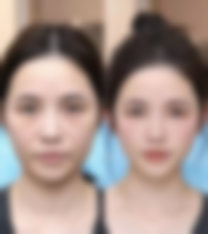 李惠圆个人资料及简历