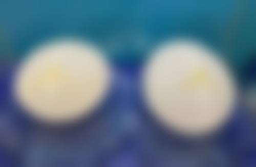 五、海口壹加壹整形医院怎么预约：