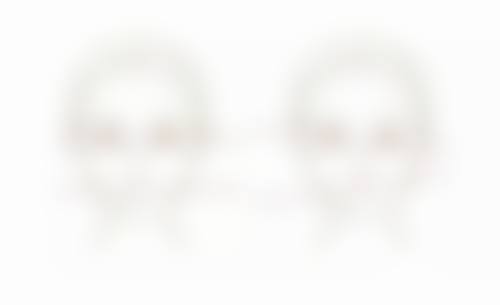 虞美人裸妆仙子隆鼻效果究竟如何？高黏合玻尿酸塑形持久，两年仍能保持一定效果 