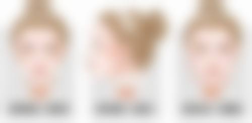 治好疤痕疙瘩的药如何？其他药物也给力