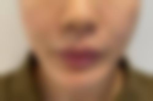 韩昇烈怎么预约？