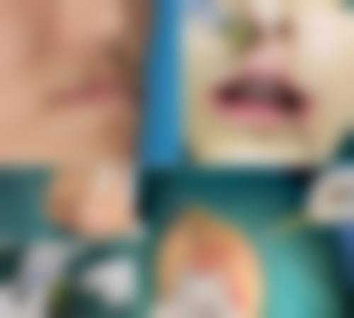 秦志慧怎么预约？