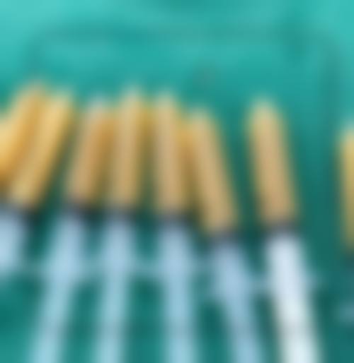 秦志慧自体脂肪填充实例