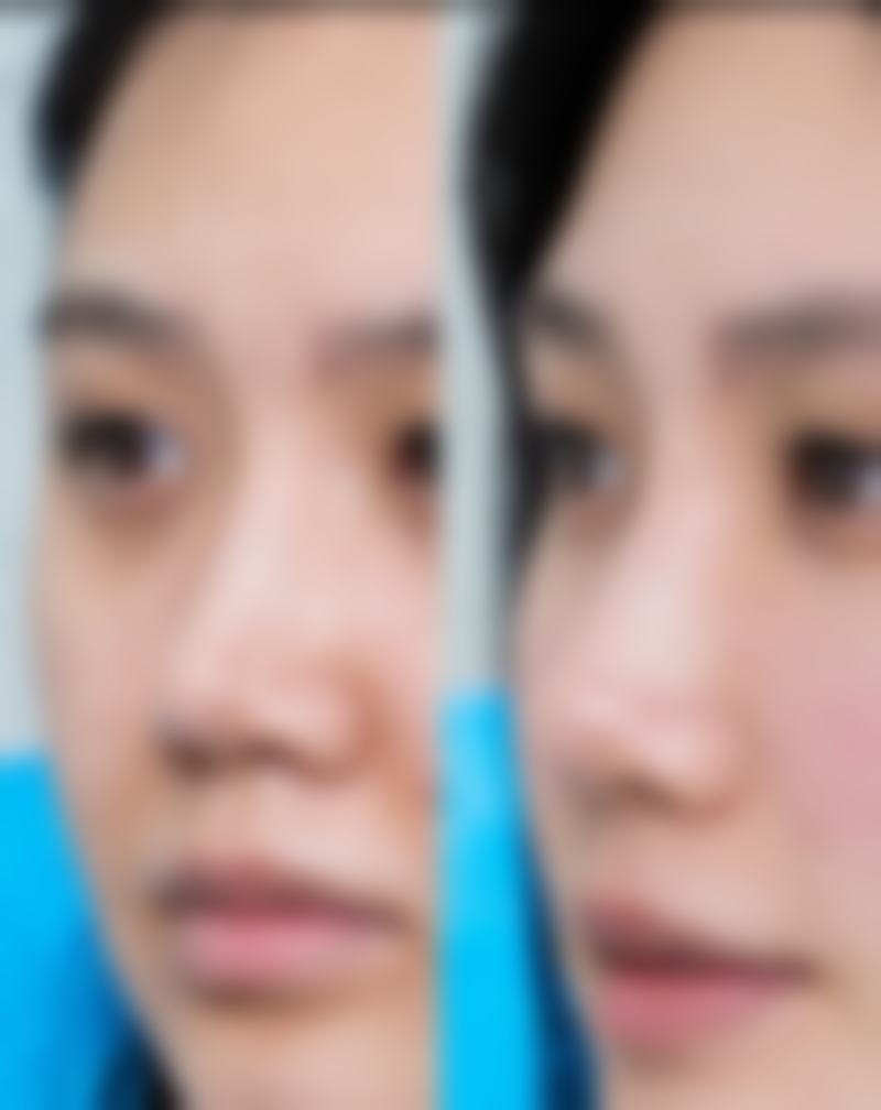 七、韩国GLAM格拉姆整形外科价格表:(仅供参考)