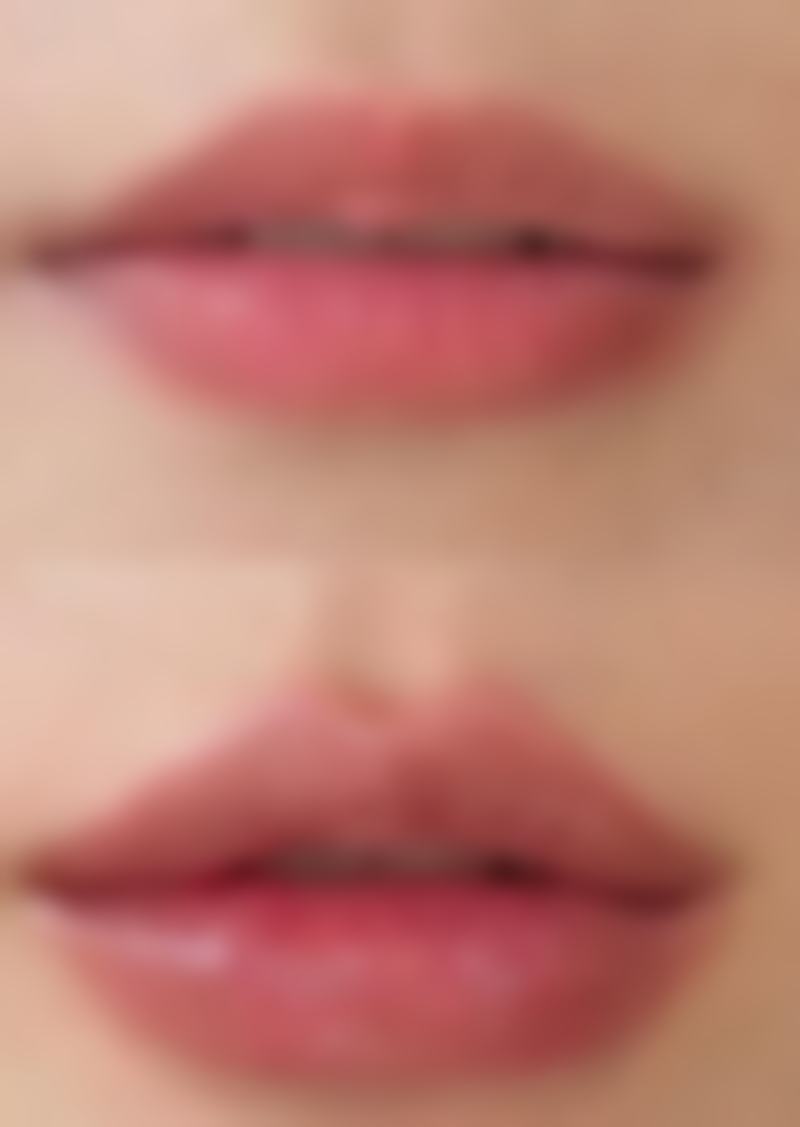 肚子吸脂后如何保持成效?合理规划助你长久美丽