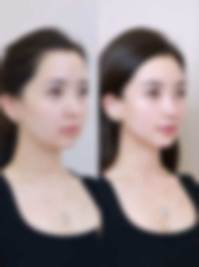 治好疤痕疙瘩的药咋选？医院来助力