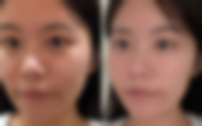 董丽娟怎么预约？