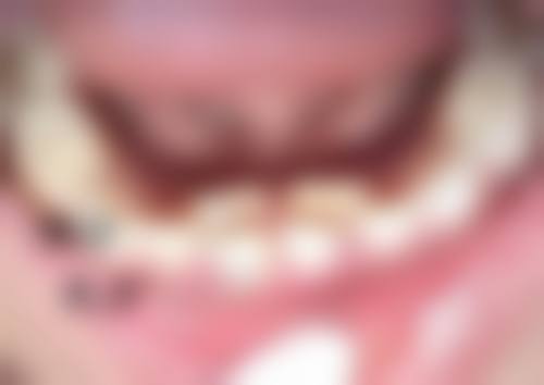 五、深圳国安门诊部怎么预约：