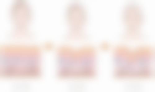 开眼角切双眼皮修复：分阶段特点