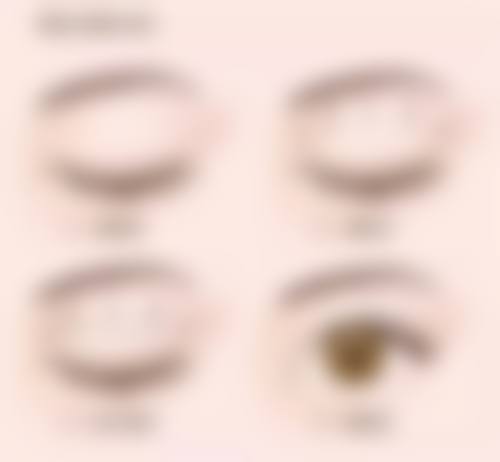 张劲松眼部整形项目价格表参考