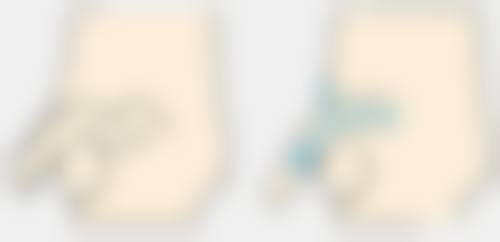 切开法修复，重获美丽的秘诀