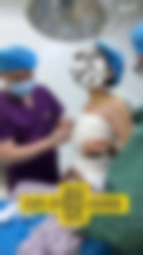 张广宇隆鼻实例