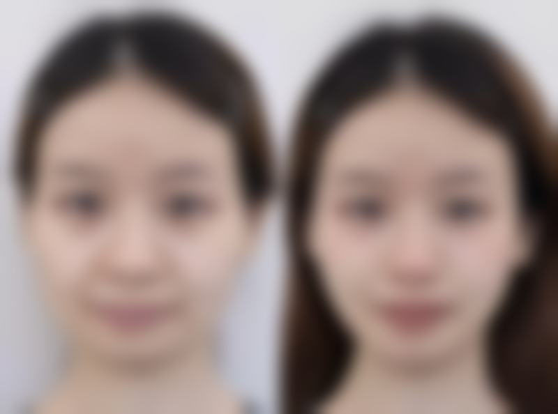 五、鸡西御美整形医院实例