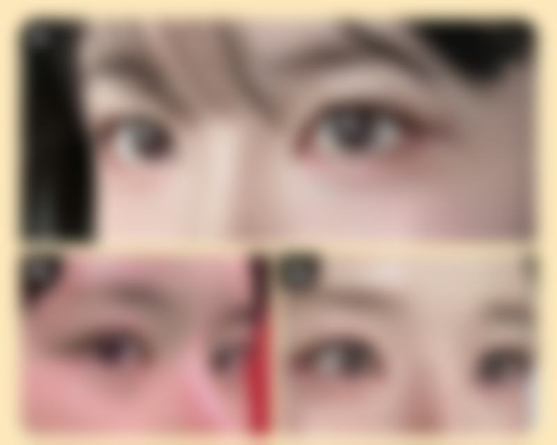 李惠圆在哪家医院