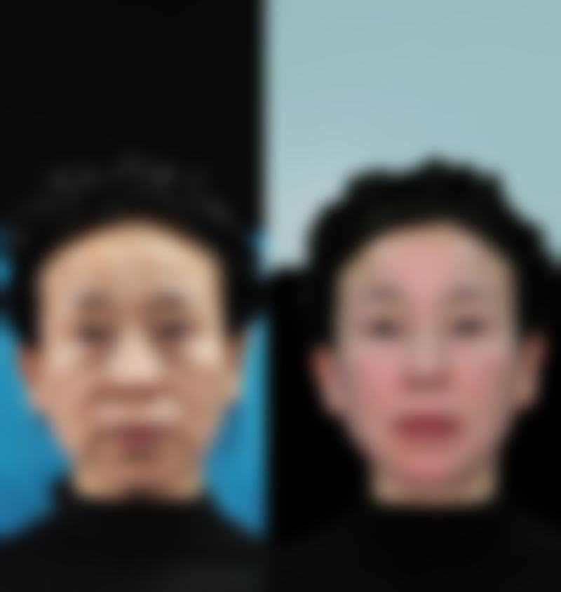 揭秘消除眼袋按摩法之按摩注意事项