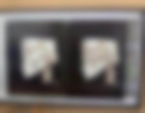 揭秘消除眼袋按摩法结合医美手段与日常护理