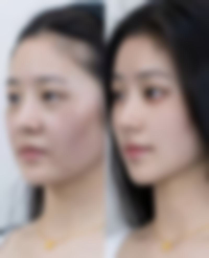 六、昆明明瑞医疗美容诊所价格表：（仅供参考）