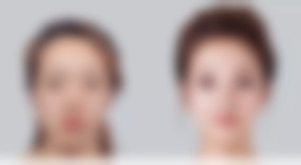 郑秉薰鼻部整形水平怎么样可靠吗?