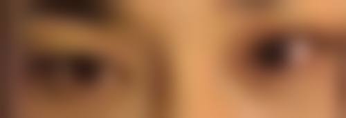 火龙果去眼袋与其他方法的对比优势：天然又健康