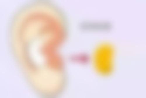 搭配专精治疗方案:疤痕贴怎么“组队”?