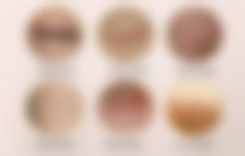 六、西安恩馨恩喜整形医院价格表：（仅供参考）