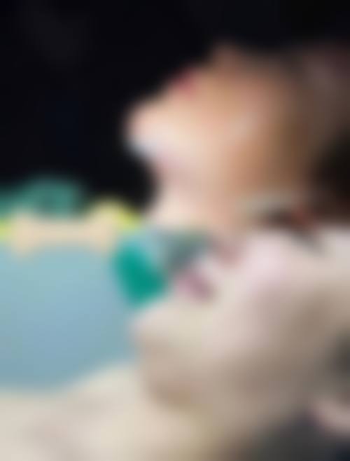 金东一鼻部手术实例